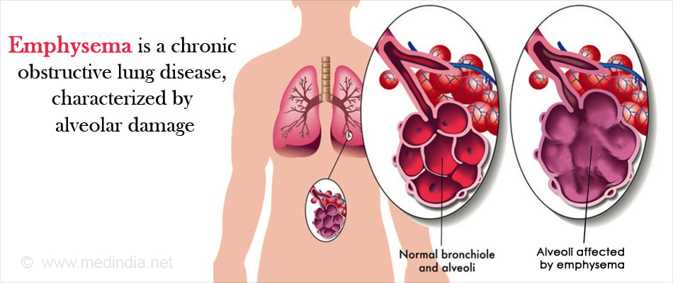 This Is What Copd Looks Like In The Lungs