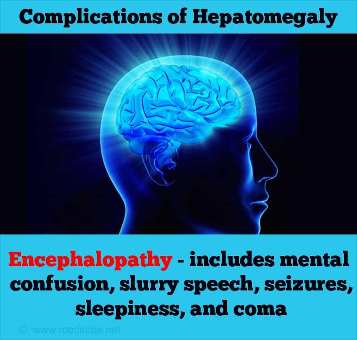 Hepatomegaly - Causes, Symptoms, Diagnosis, Treatment & Prevention