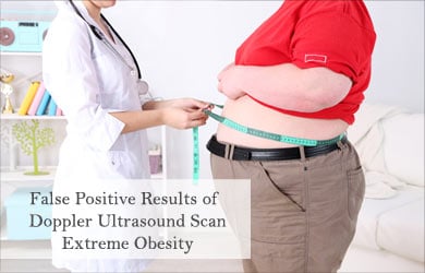Extreme Obesity Extreme Obesity