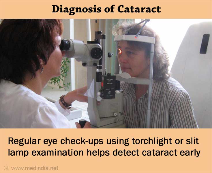 Cataract - Causes, Symptoms, Diagnosis, Treatment & Prevention