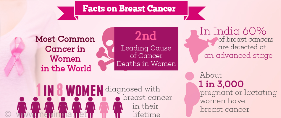 Facts on Breast Cancer Facts on Breast Cancer