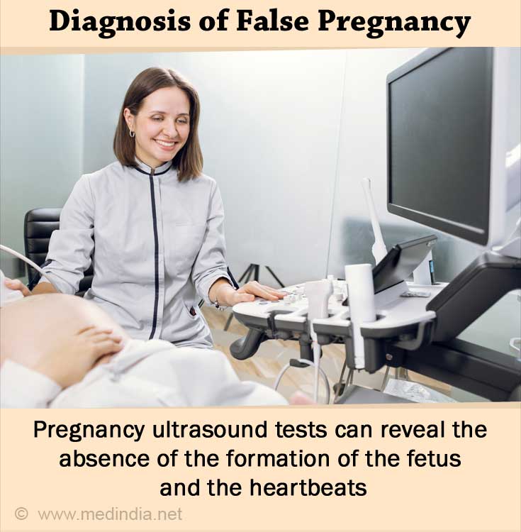 false-pregnancy-pseudocyesis-causes-symptoms-signs-diagnosis