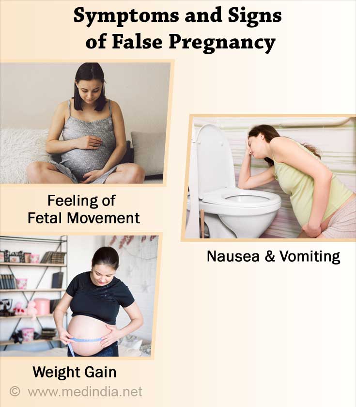 False Pregnancy Pseudocyesis Causes Symptoms And Signs Diagnosis Treatment