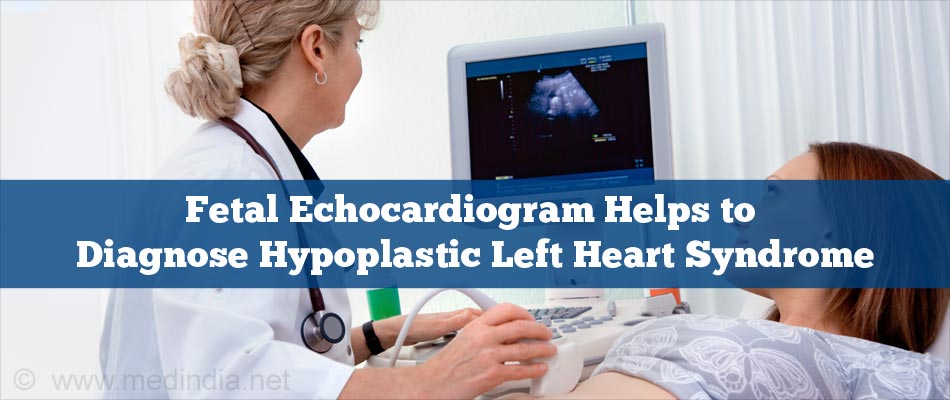 Fetal Echocardiogram Helps to Diagnose Hypoplastic Left Heart Syndrome Fetal Echocardiogram Helps to Diagnose Hypoplastic Left Heart Syndrome