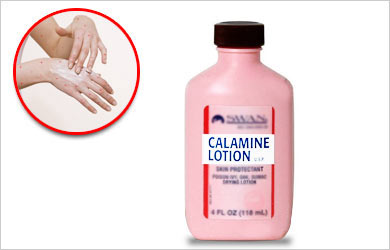 Flea Bites Calamine Lotion Flea Bites Calamine Lotion