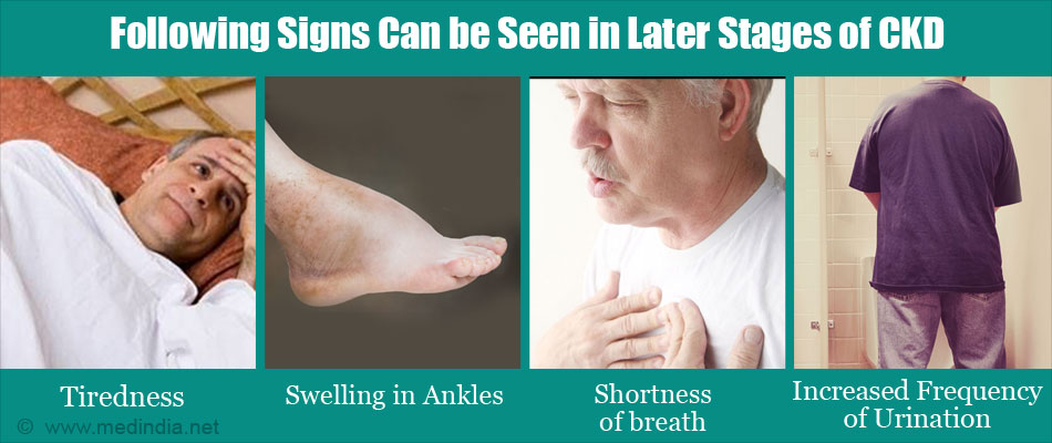 Following Signs Can be Seen in Later Stages of CKD Following Signs Can be Seen in Later Stages of CKD