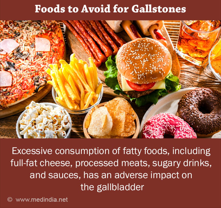 Gallstone Diet: Foods to Eat and Foods to Avoid