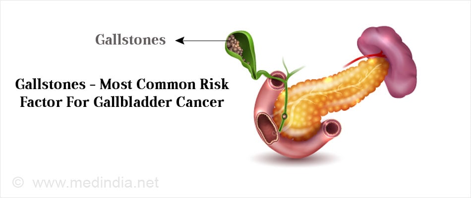 Gallbladder Cancer Types