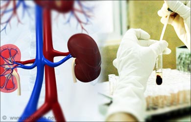 Gastroenteritis Kidney Test Gastroenteritis Kidney Test