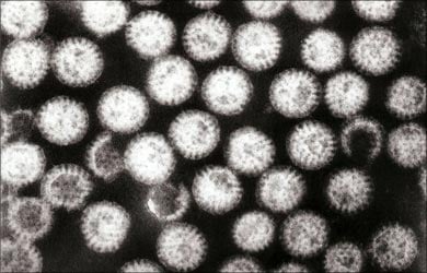 Gastroenteritis Rota Virus Gastroenteritis Rota Virus