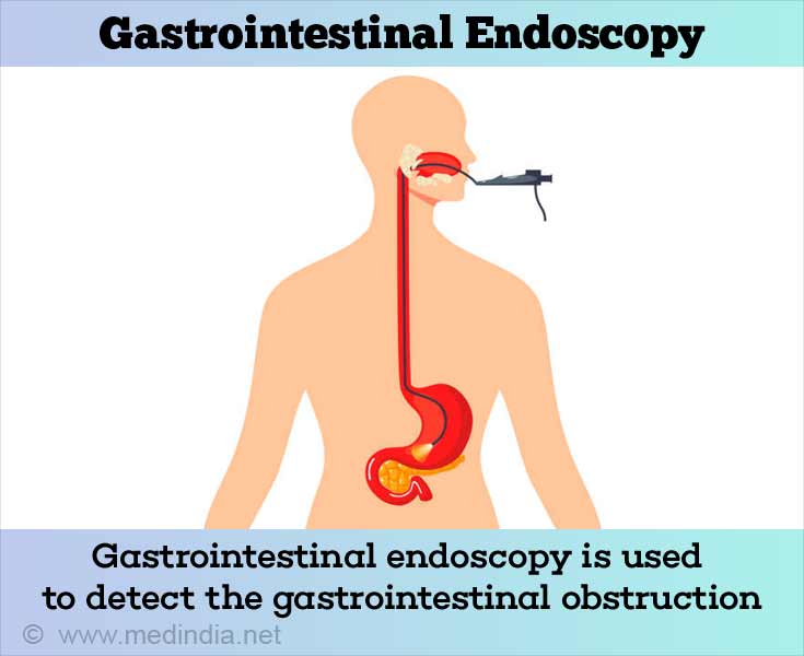 Diagnosis of Pyloric Stenosis - Gastrointestinal Endoscopy Diagnosis of Pyloric Stenosis - Gastrointestinal Endoscopy