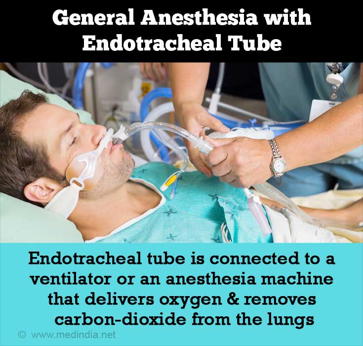 endo ablation recovery