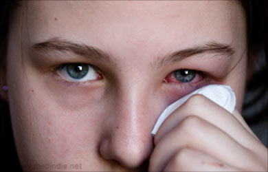 Granulated Eyelids Itchy Eyelids Granulated Eyelids Itchy Eyelids