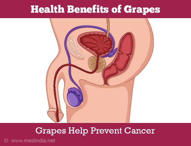 Grapes Prevent Prostate Cancer Grapes Prevent Prostate Cancer