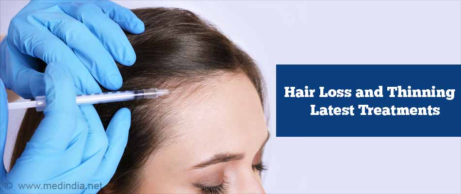 Dr Simrans guide to allopathic hair loss treatment options