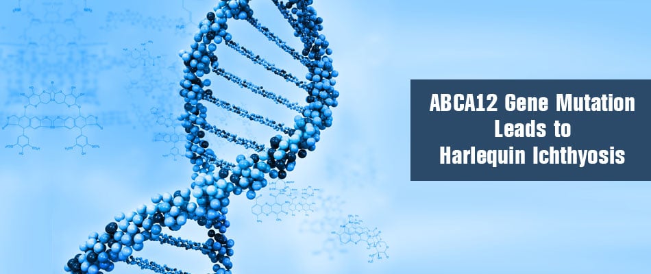 Harlequin Ichthyosis Causes Gene Mutation Harlequin Ichthyosis Causes Gene Mutation