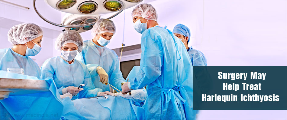 Harlequin Ichthyosis Treatment Surgery Harlequin Ichthyosis Treatment Surgery