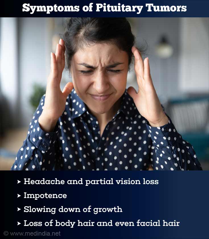 Can The Pituitary Gland Cause Headaches