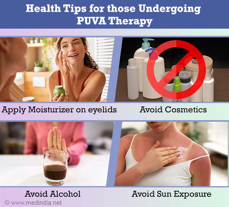 Health Tips for PUVA Therapy Health Tips for PUVA Therapy