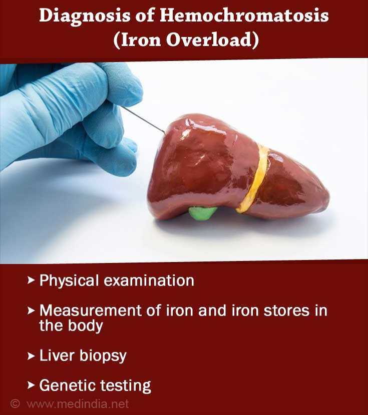 Hemochromatosis Iron Overload Causes Symptoms Diagnosis