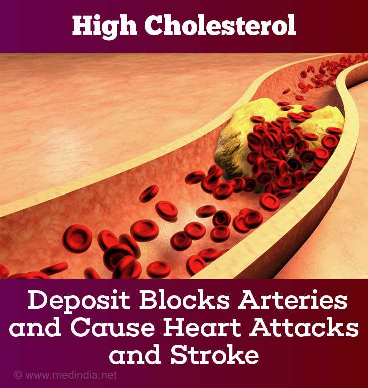 High Cholesterol Hypercholesterolemia Causes Symptoms Diagnosis And Treatment 5966