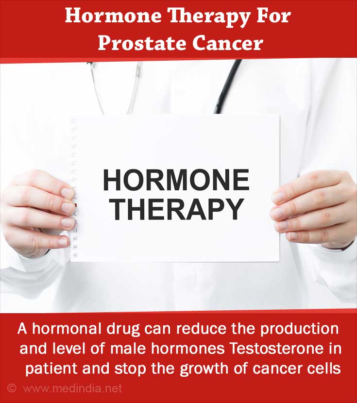 Medical Management Of Prostate Cancer 3078