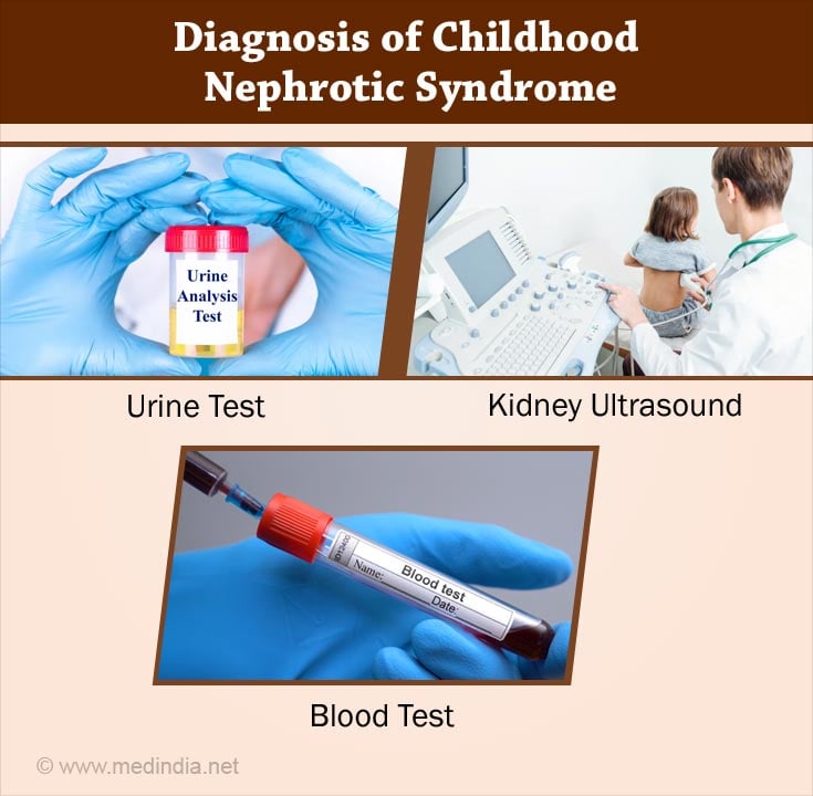 Childhood Nephrotic Syndrome - Causes, Risk Factors, Symptoms 