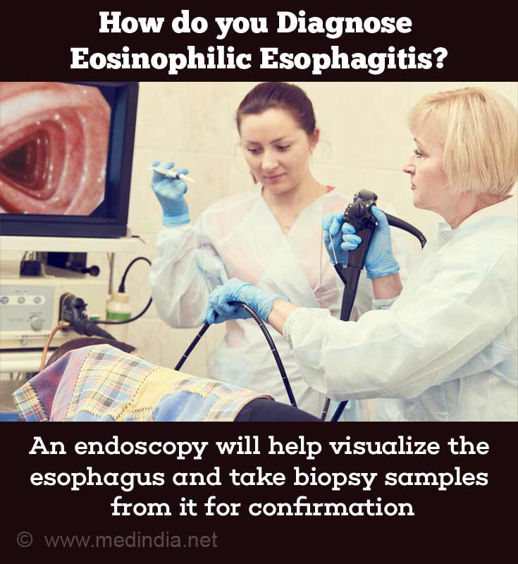 eosinophilic-esophagitis-eoe-allergic-esophagitis-causes