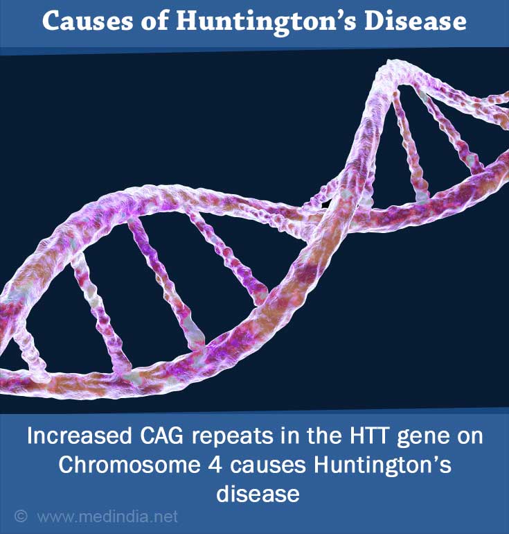 Huntingtons Disease Huntingtons Chorea Causes Symptoms Diagnosis Treatment 1534