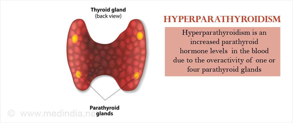 Does Hyperparathyroidism Cause Swelling