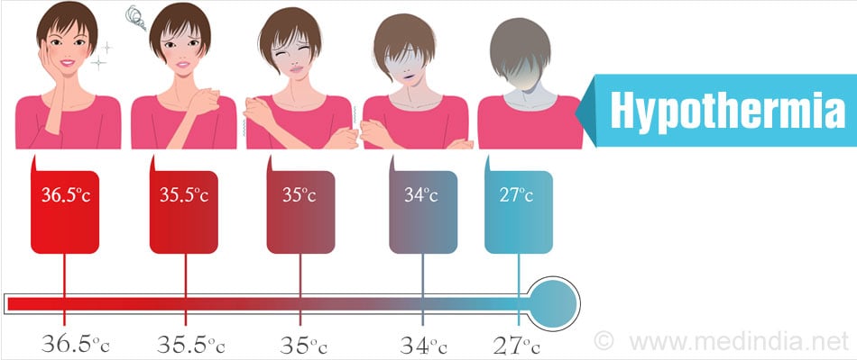 Hypothermia Causes Risk Factors Symptoms Diagnosis Treatment