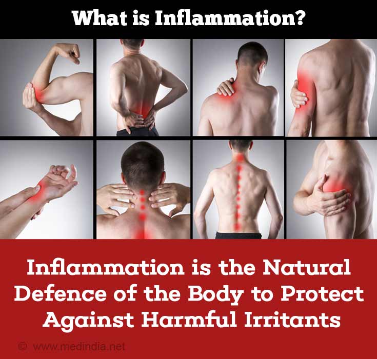 Inflammation Inflammation