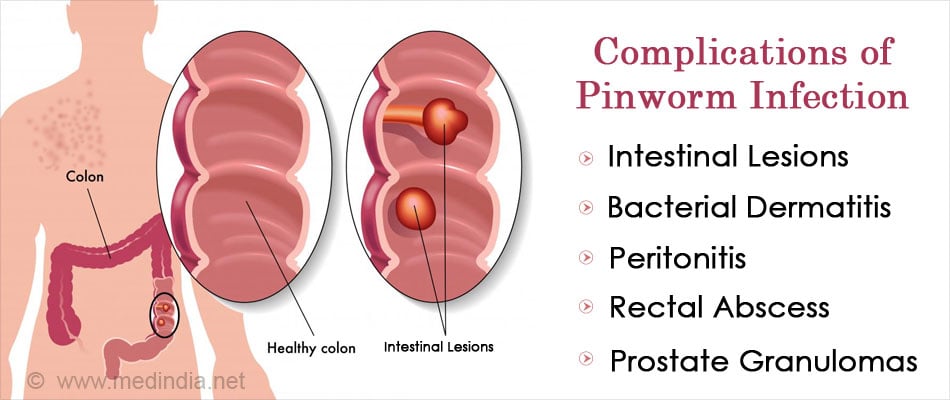 pin worms in humans