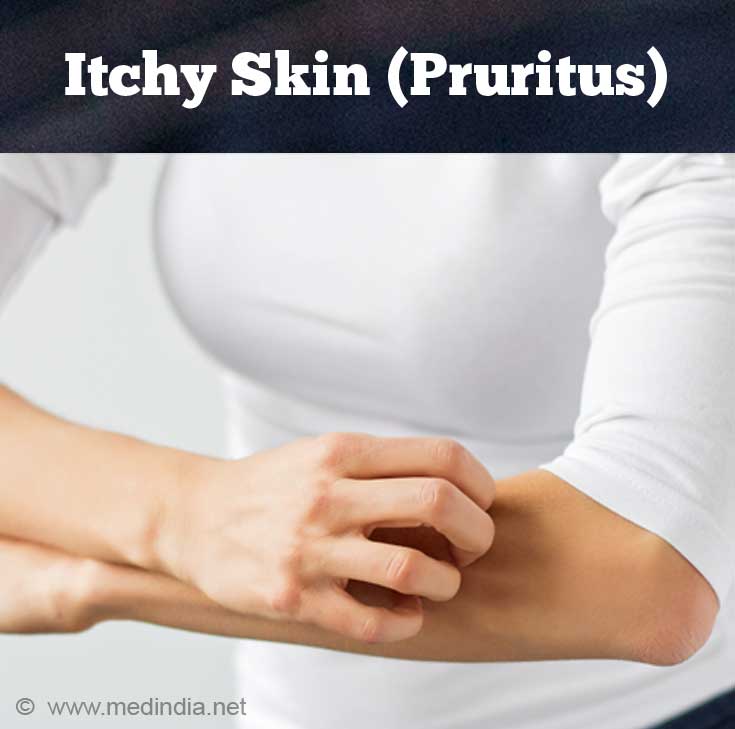 Itchy Skin/Pruritus Itchy Skin/Pruritus