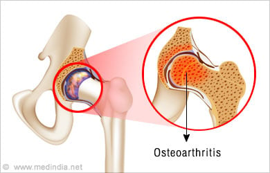 Leg Injuries and Disorders - Common Problems - Conditions