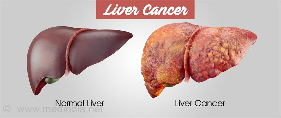 Normal Liver Size and Your Health