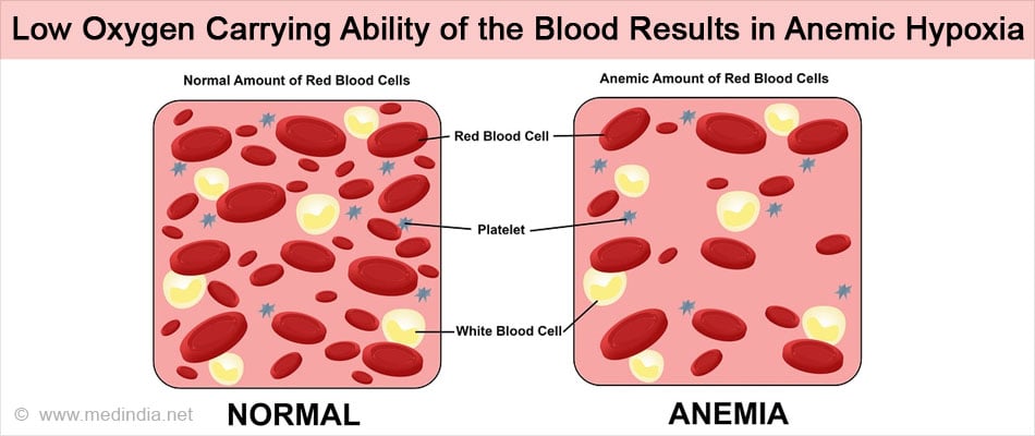 Anemia oxygen shop