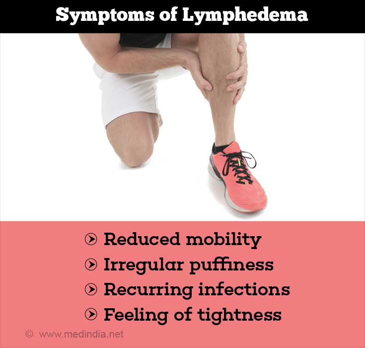 Lymphedema Types Causes Symptoms Diagnosis Treatment