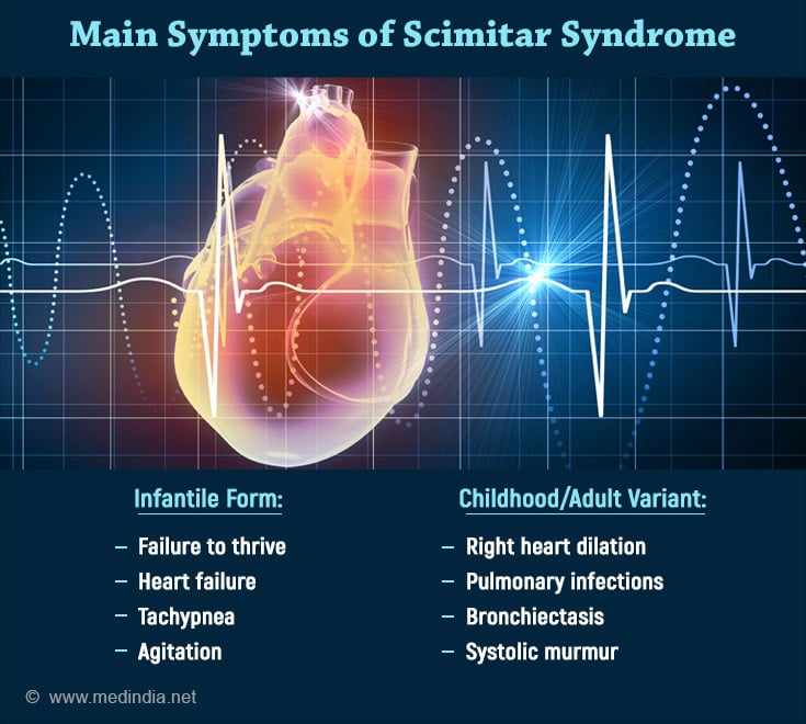 Scimitar Syndrome: A Rare Congenital Heart Defect