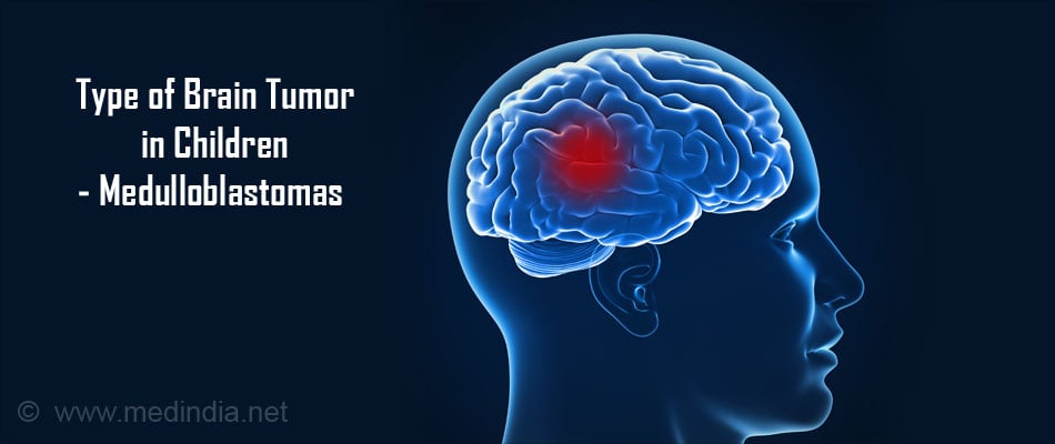 Brain Tumor in Children Types, Causes, Symptoms