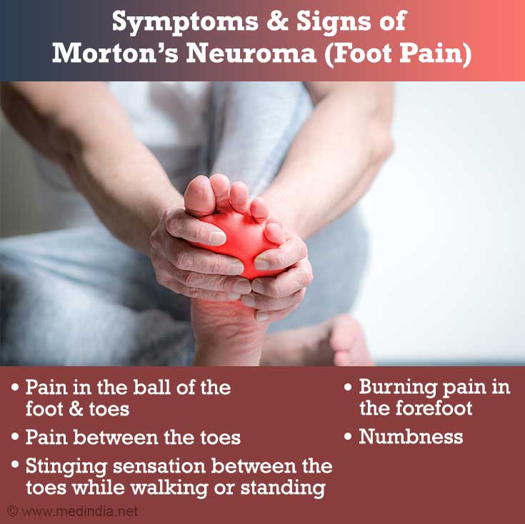 Morton S Neuroma Causes Symptoms Diagnosis Treatment Prevention