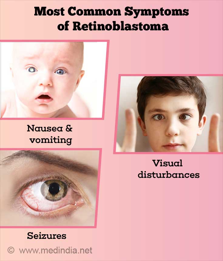 Most Common Symptoms of Retinoblastoma