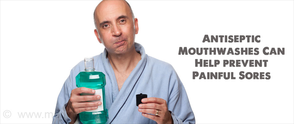 Antiseptic Mouthwashes Can Help prevent Painful Sores Antiseptic Mouthwashes Can Help prevent Painful Sores