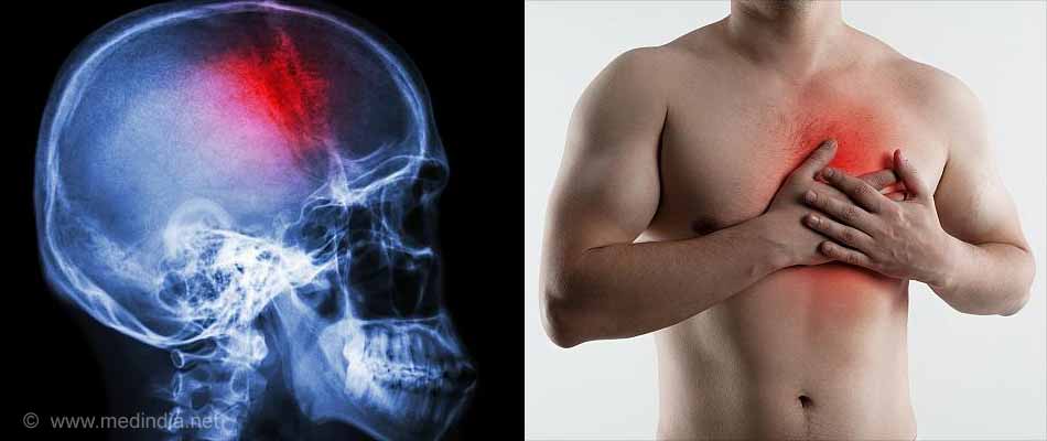 Mouthwash: Stroke and Heart Attack Mouthwash: Stroke and Heart Attack