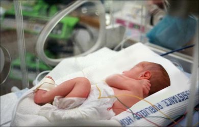 Multiple Pregnancy Low Birth Weight Multiple Pregnancy Low Birth Weight