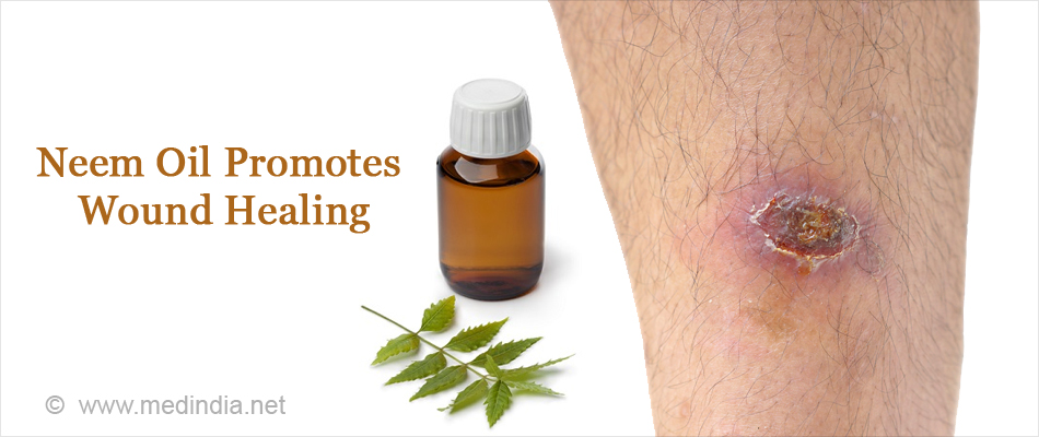 Neem Oil Promotes Wound Healing Neem Oil Promotes Wound Healing
