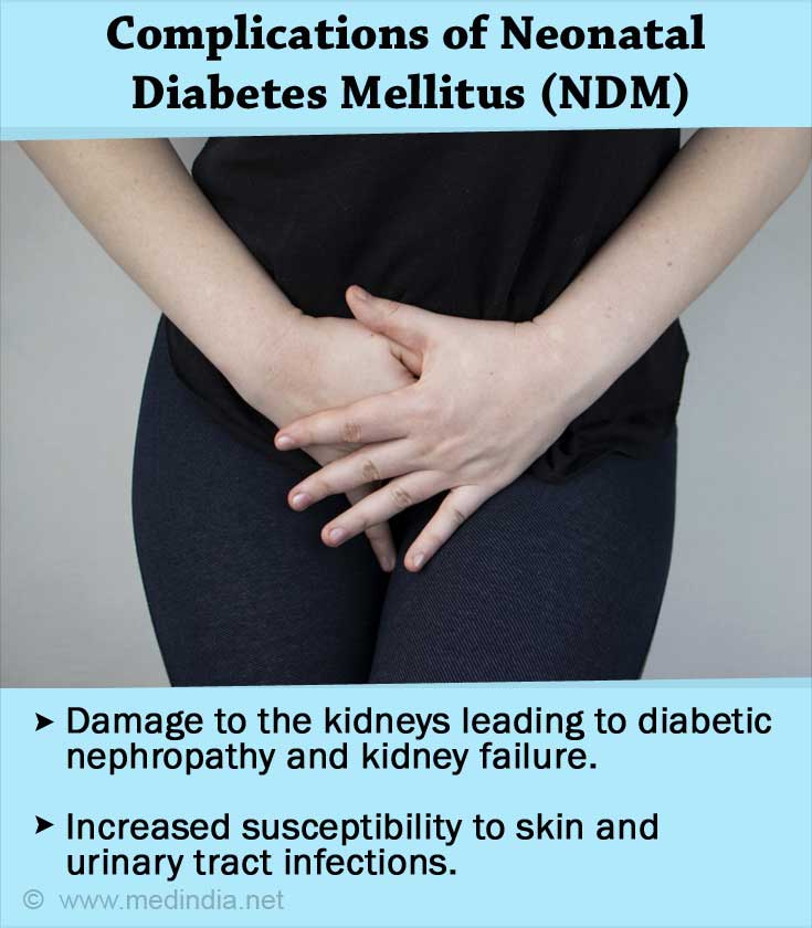 Neonatal Diabetes Mellitus Complication Neonatal Diabetes Mellitus Complication