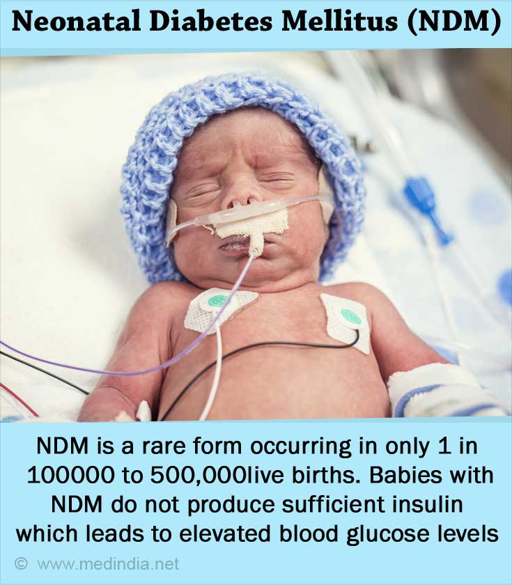 neonatal diabetes presentation