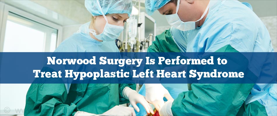 Norwood Procedure Surgery Is Performed to Treat Hypoplastic Left Heart Syndrome Norwood Procedure Surgery Is Performed to Treat Hypoplastic Left Heart Syndrome