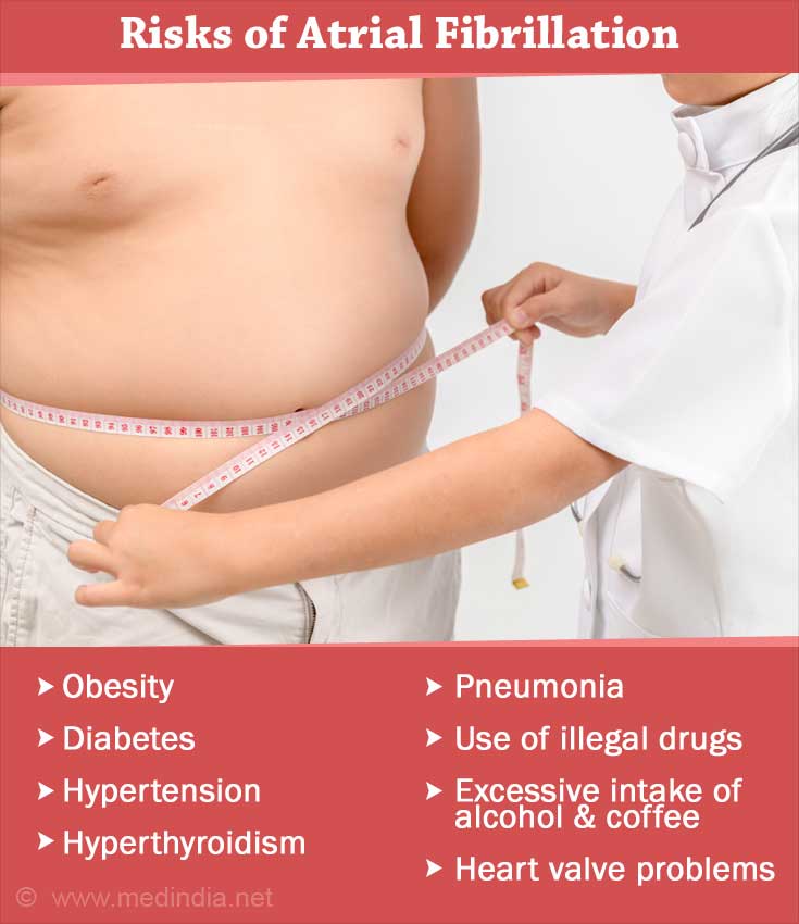 Obesity and Atrial Fibrillation Obesity and Atrial Fibrillation